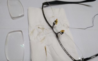 金属眼镜松了怎么办，金属眼镜松了怎么办小妙招